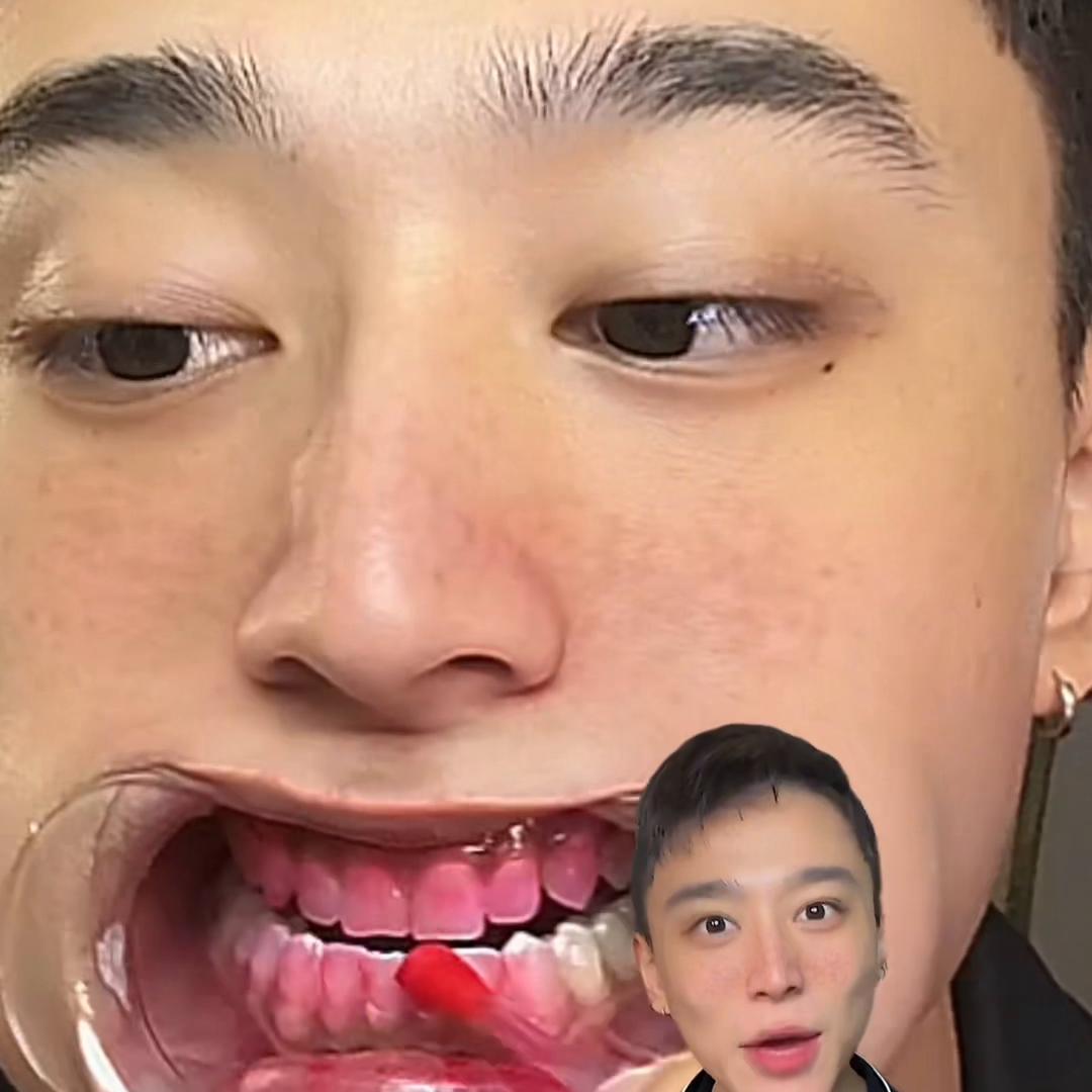 国家种植牙价格调整最新动态,启程自然美景之旅,笑容从此绽放!