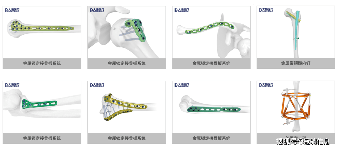 最新骨科耗材,最新骨科耗材,小巷深处的隐藏宝藏