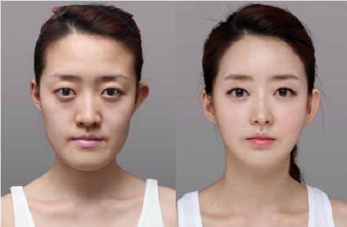 最新整容技术的深度分析与阐述